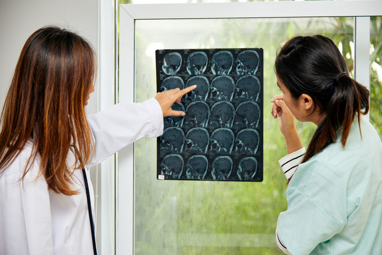 Traumatic Brain Injuries Lawyers in Irvine